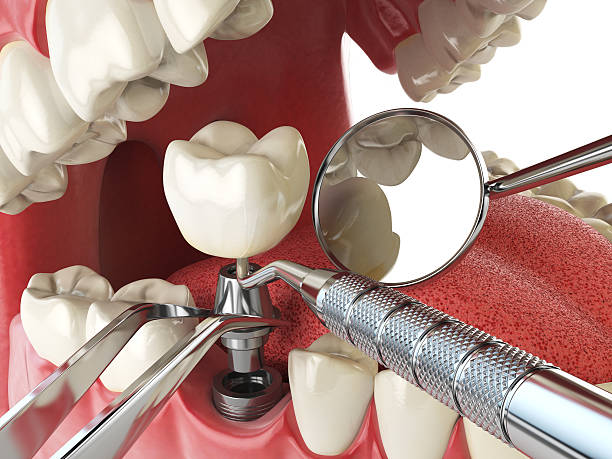 Best Weekend Emergency Dentist in Kosciusko, MS
